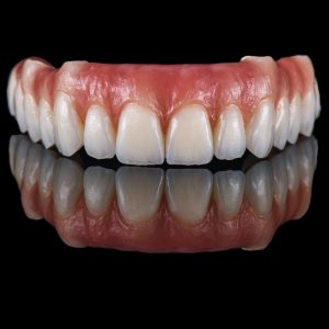 denture model