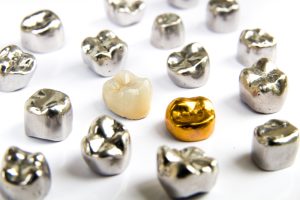 metal crowns