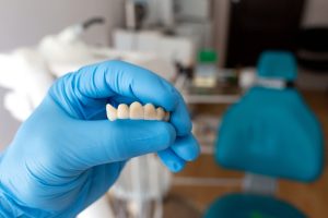 zirconia veneer