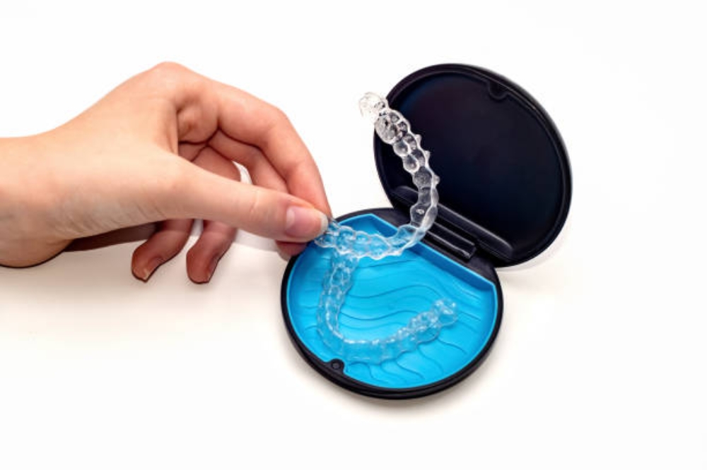 Does Invisalign Hurt? What to Expect in the First 30 Days